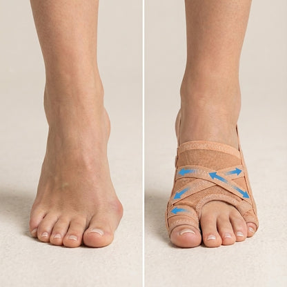 Lovara™ Bunion Corrector